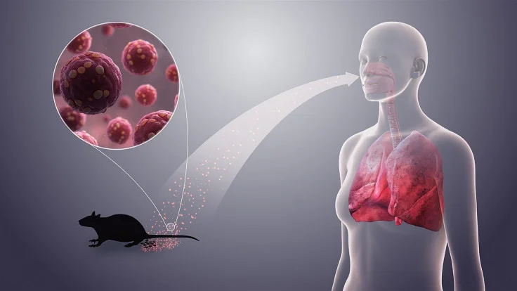 hantavirus symptoms